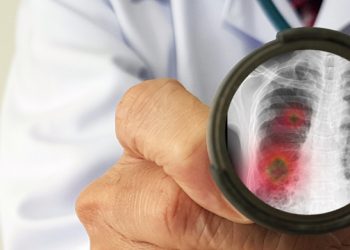Waspada Pneumonia, Kemenkes Minta Semua Jajaran Kesehatan Siaga