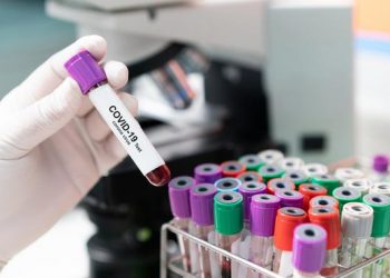 Update Senin 4 Januari 2021: Positif Covid-19 772.103, Sembuh 639.103, Meninggal 22.911