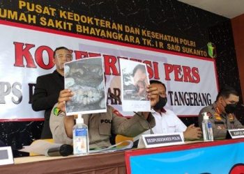 Kondisi Gigi Patah Jadi Petunjuk Tim DVI Identifikasi 2 Jenazah Korban Kebakaran Lapas Tangerang