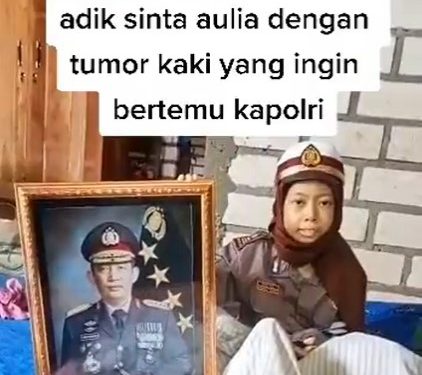 Kapolri Merespons Permintaan Sinta Aulia, Anak Penderita Tumor Kaki
